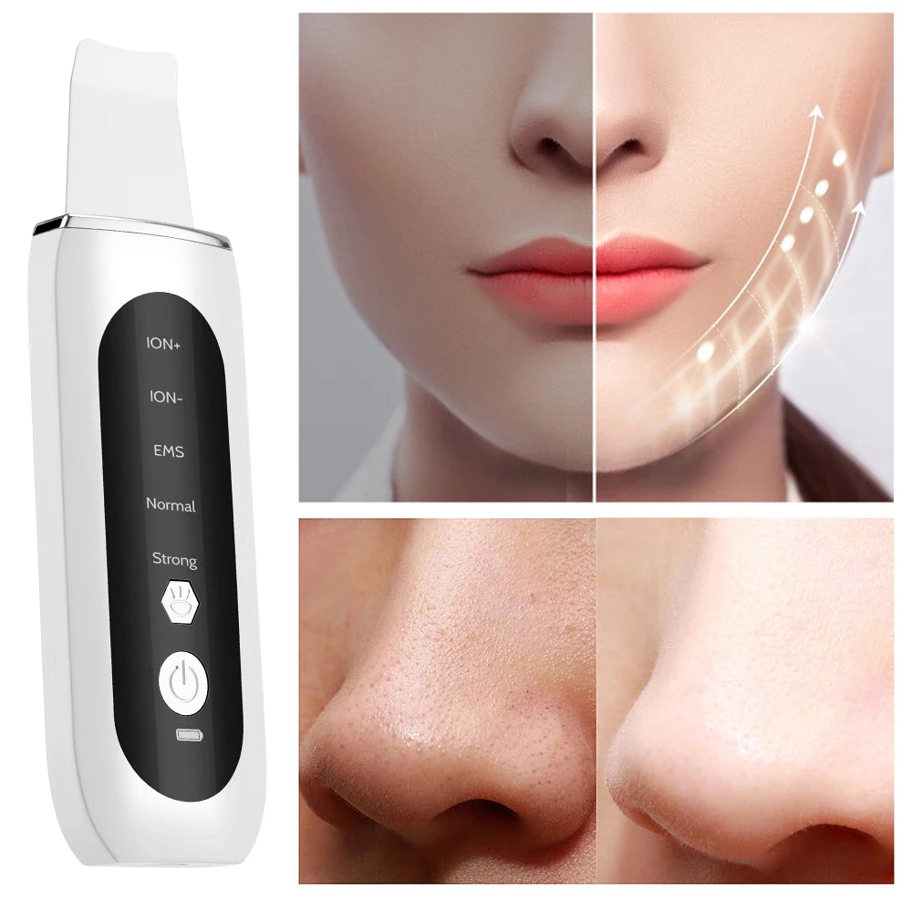 5-in-1 Ultrasonic Skin Scrubber